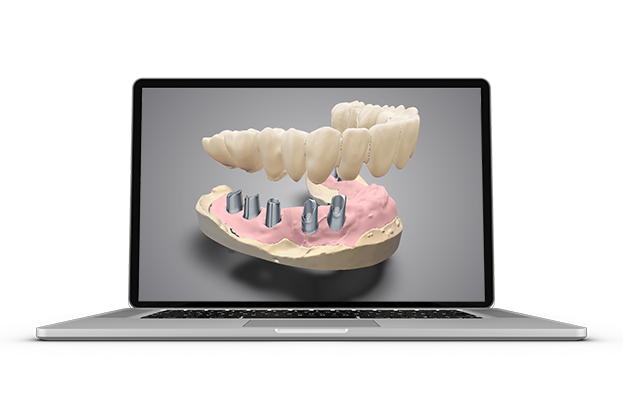 DWOS CAD CAM Implant-prosthetics-_new